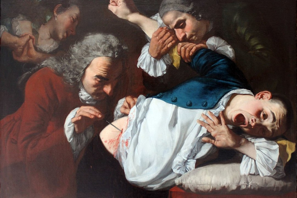 Роды без анестезии. Гаспаре траверси картины. Гаспаре траверси операция. Гаспаре траверси (1722-1770).