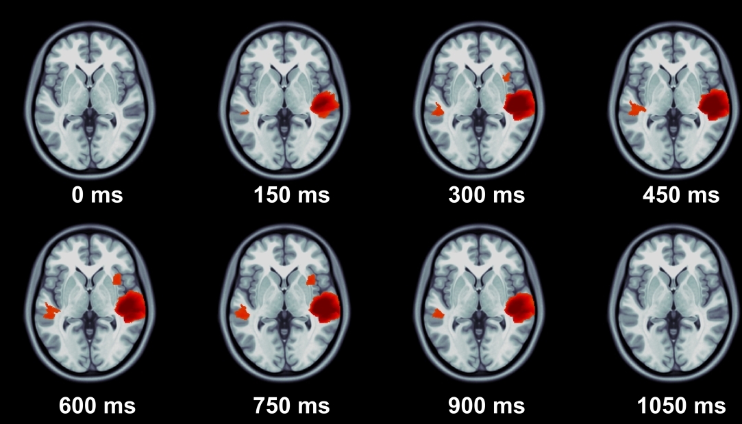 Иллюстрация к новости: Новая статья Центра языка и мозга вышла в журнале Human Brain Mapping